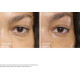 Total Eye Lift au Rétinol Naturel